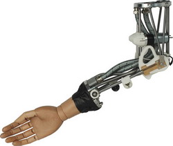 Бионическая рука ISELLA